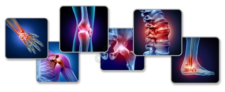 人体膝关节疼痛骨骼肌肉解剖的三维插图元素高清图片下载-正版图片300888365-摄图网